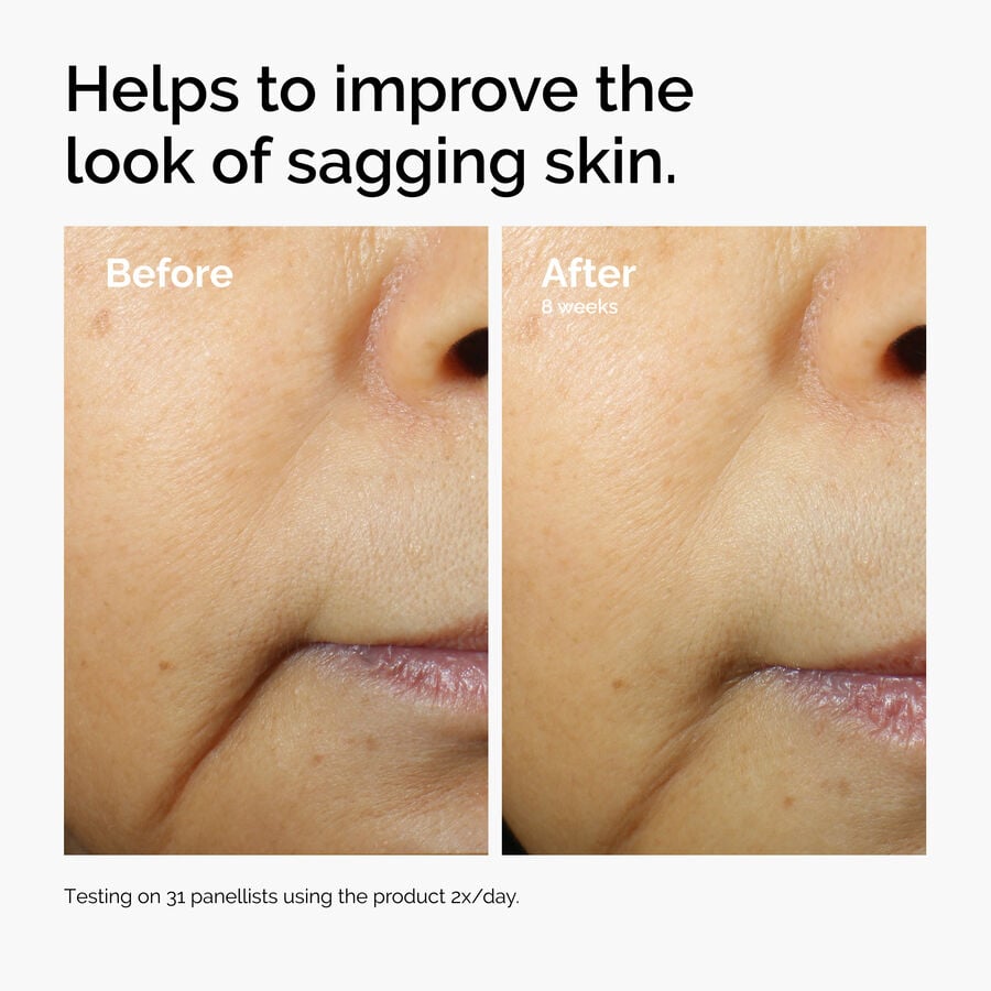 caffeine-3-escin-1-face-serum-x6 ord-caffeine-3pct-escin-1pct-face-serum-before-after-sagging.jpg
