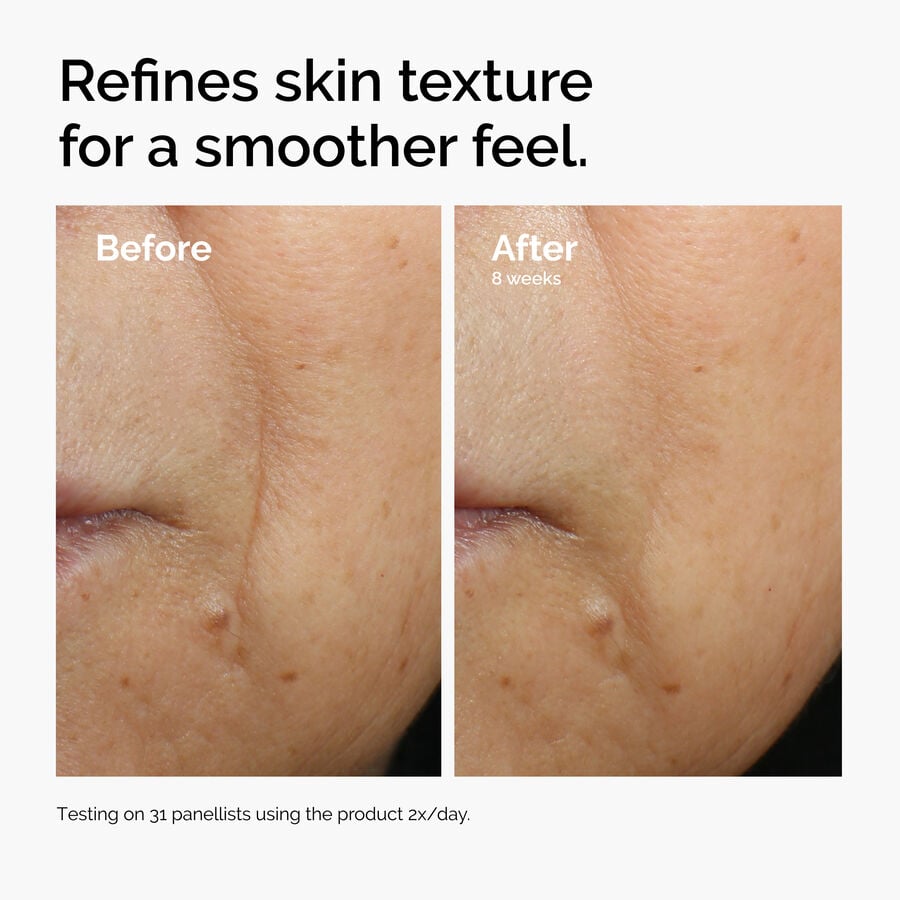 caffeine-3-escin-1-face-serum-x6 ord-caffeine-3pct-escin-1pct-face-serum-before-after-texture.jpg