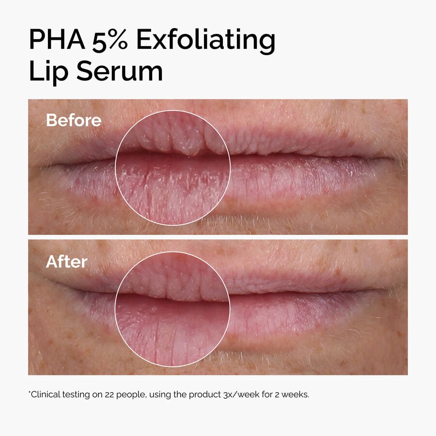 pha-5-exfoliating-lip-serum-y7 ord-pha-5pct-lip-exfoliating-serum-before-after.jpg